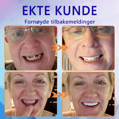 Bikenda™-🦷Avansert tilpasset helprotesesett🦷 (🔥Tidsbegrenset rabatt de siste 30 minuttene🔥)👑👑