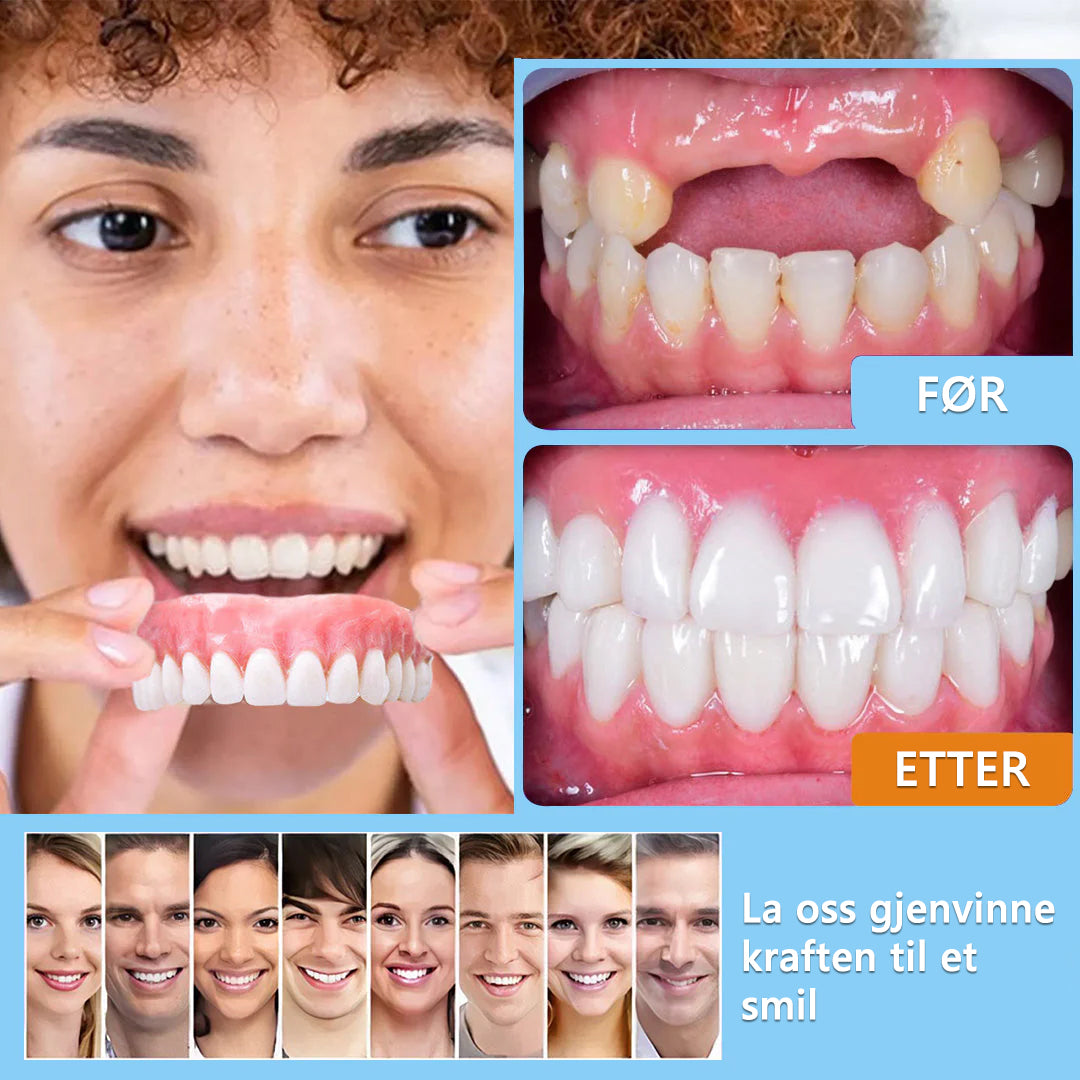 Bikenda™-🦷Avansert tilpasset helprotesesett🦷 (🔥Tidsbegrenset rabatt de siste 30 minuttene🔥)👑👑