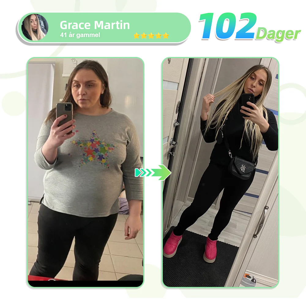 【Siste dags kampanje 60 % RABATT】👑LERCEA®Tirzepatide Slanking og helse NANO MIKRONÅLPLAST👑(Null smerte, 24/7 utløsning | Gå ned 9 kg RASKT | 90 % sukkerreduksjon | ) 👑