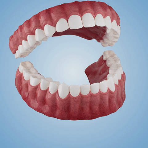 Bikenda™-🦷Avansert tilpasset helprotesesett🦷 (🔥Tidsbegrenset rabatt de siste 30 minuttene🔥)👑👑