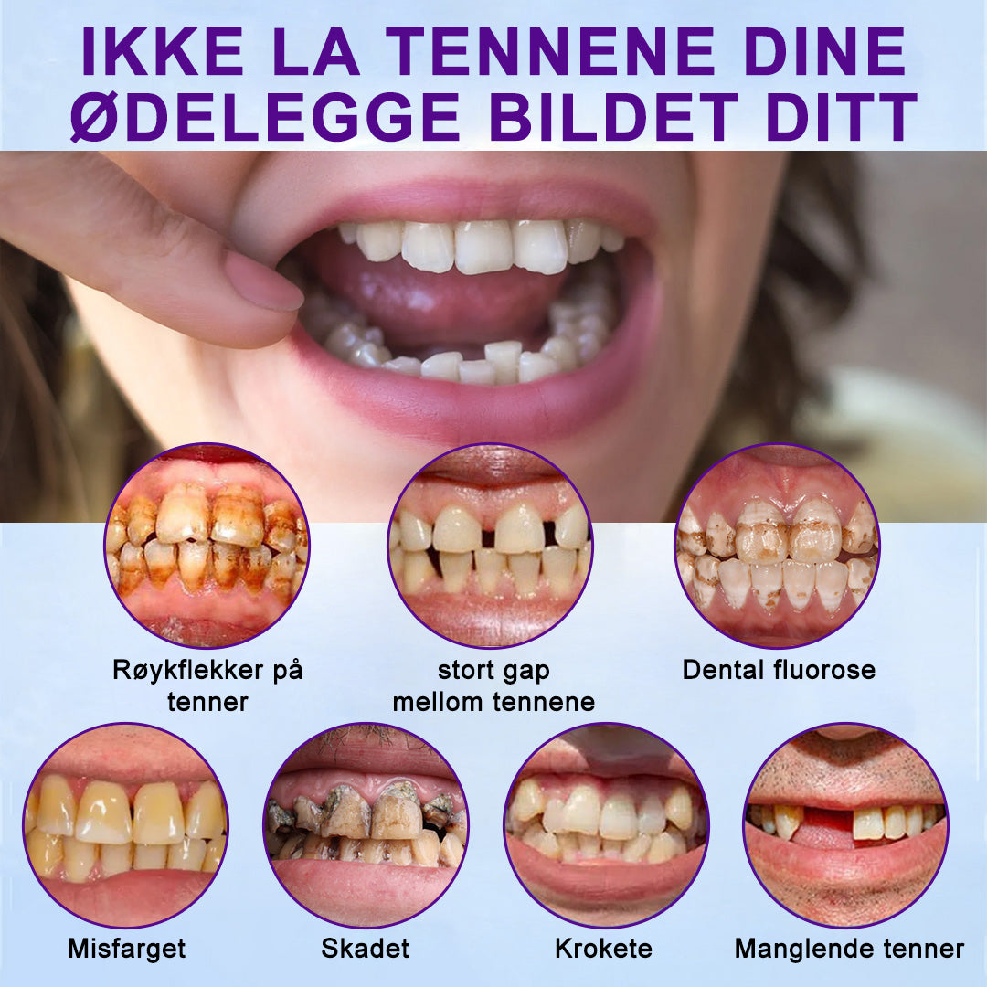 Bikenda™-🦷Avansert tilpasset helprotesesett🦷 (🔥Tidsbegrenset rabatt de siste 30 minuttene🔥)👑👑